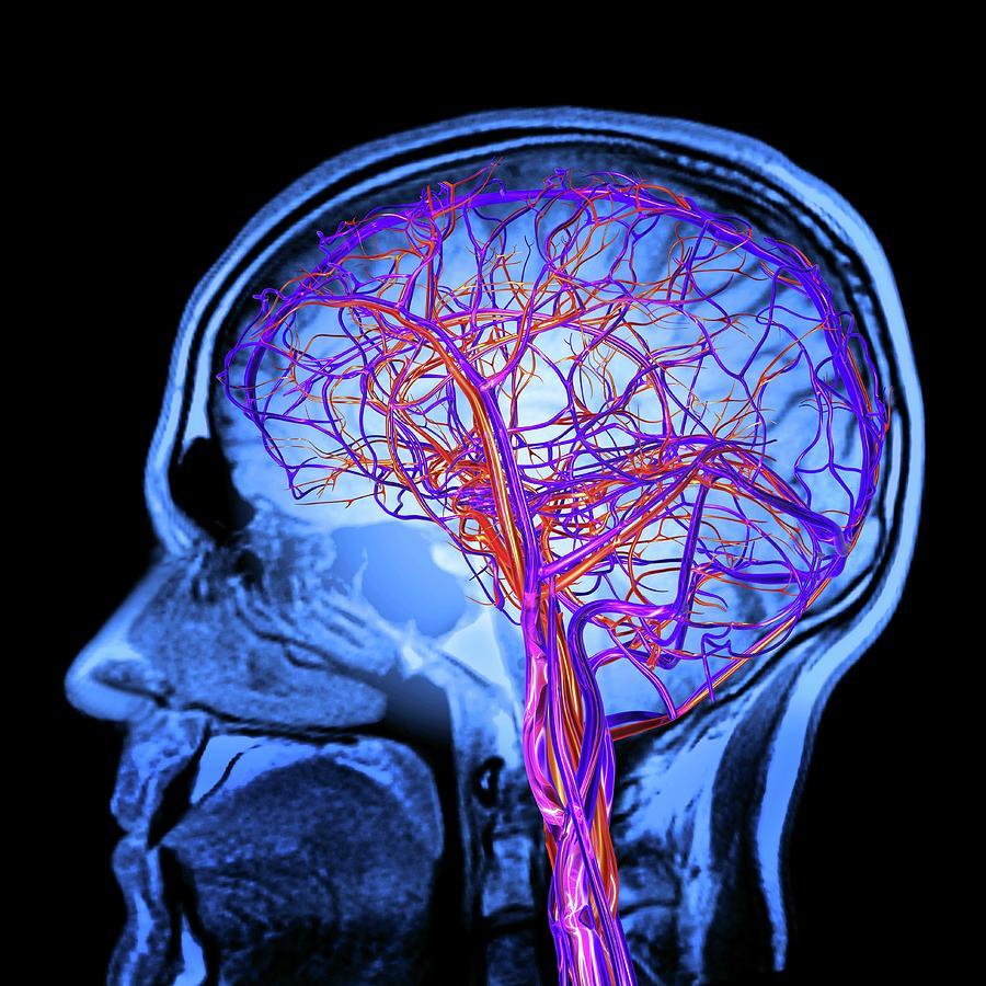 profile of head and brain 